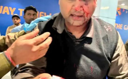 दिल्ली एयरपोर्ट T1 पर ऑफ-ड्यूटी पायलट का यात्री पर हमला, एयर इंडिया एक्सप्रेस ने किया सस्पेंड